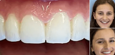 Proven Dental Treatments